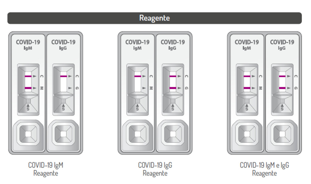 TESTE RÁPIDO COVID-19 IgG/IgM - CAIXA 40 UNIDADES - Latina Diagnostico